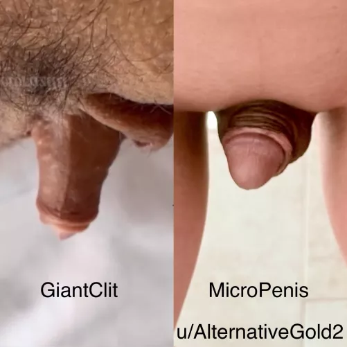 Penis vs Clitoris