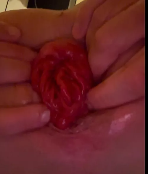 Working on my prolapse 