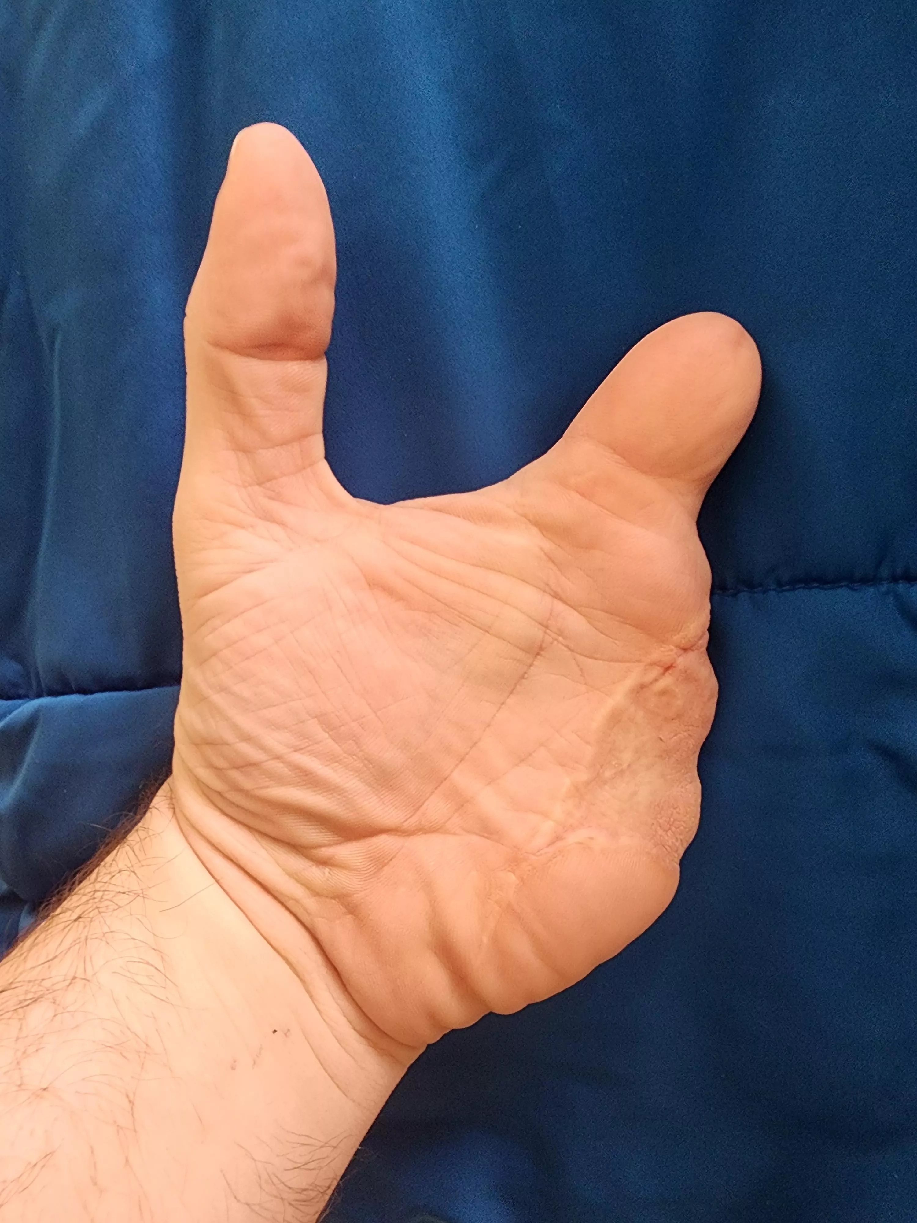 Get a grip!