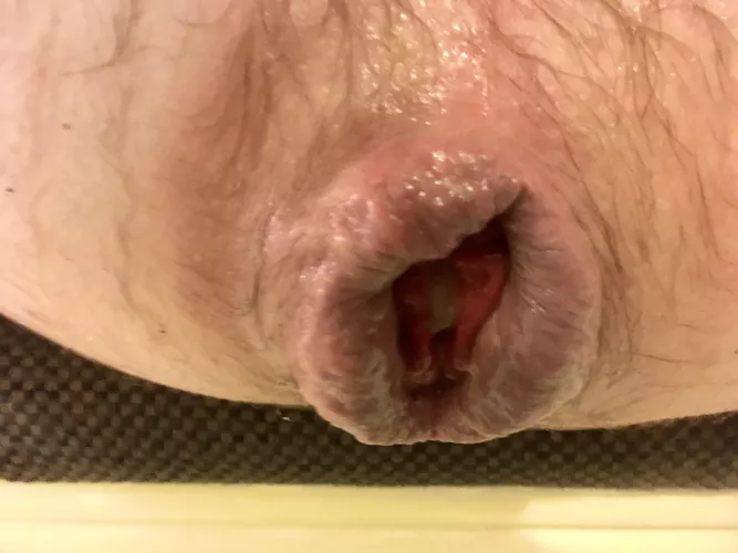 big lips means big kisses 