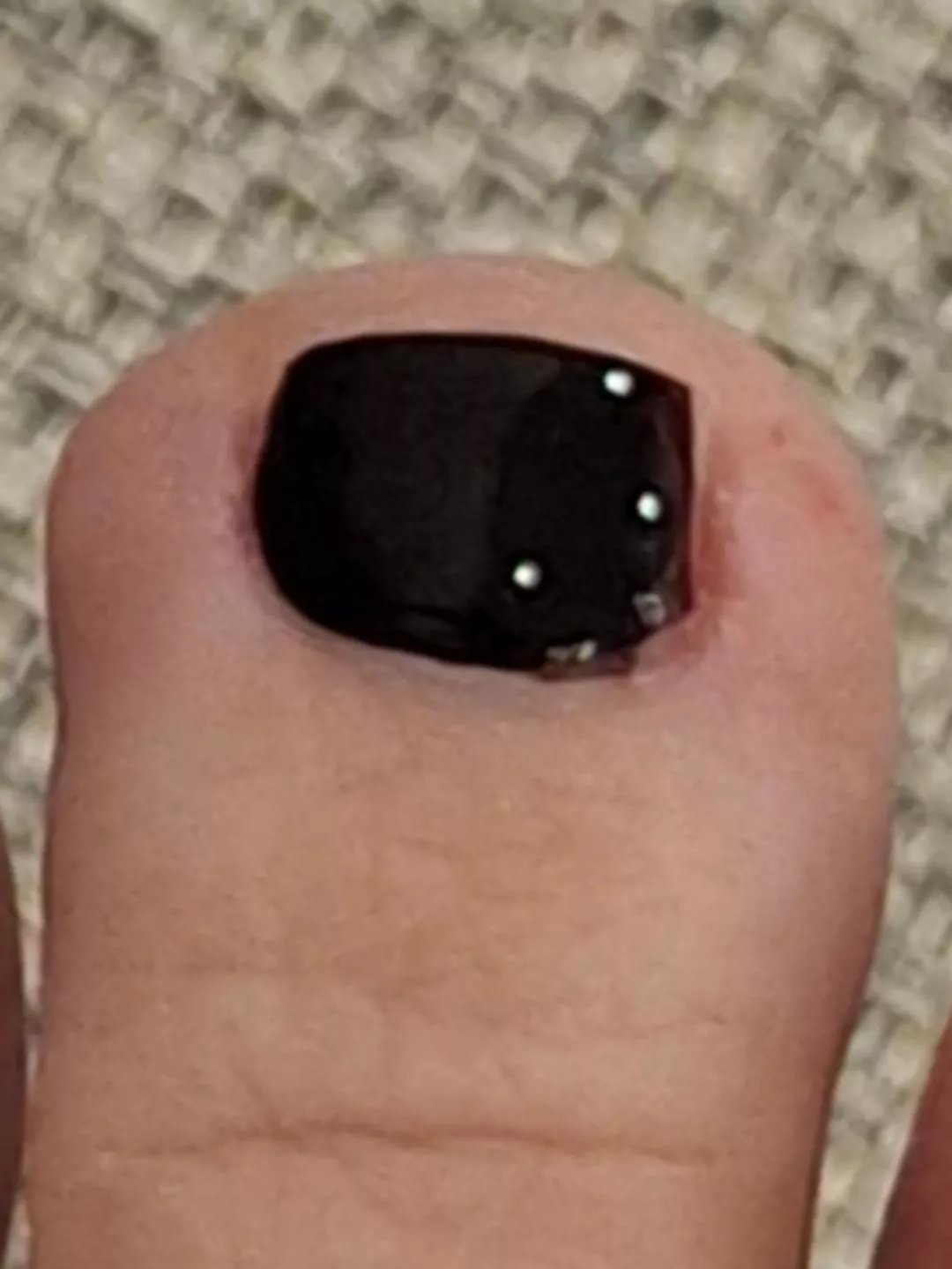 Goon to my toe, beta loser.