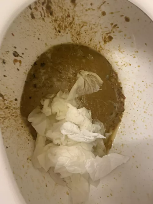 had an explosive accident 🥺 felt good to shit it out 