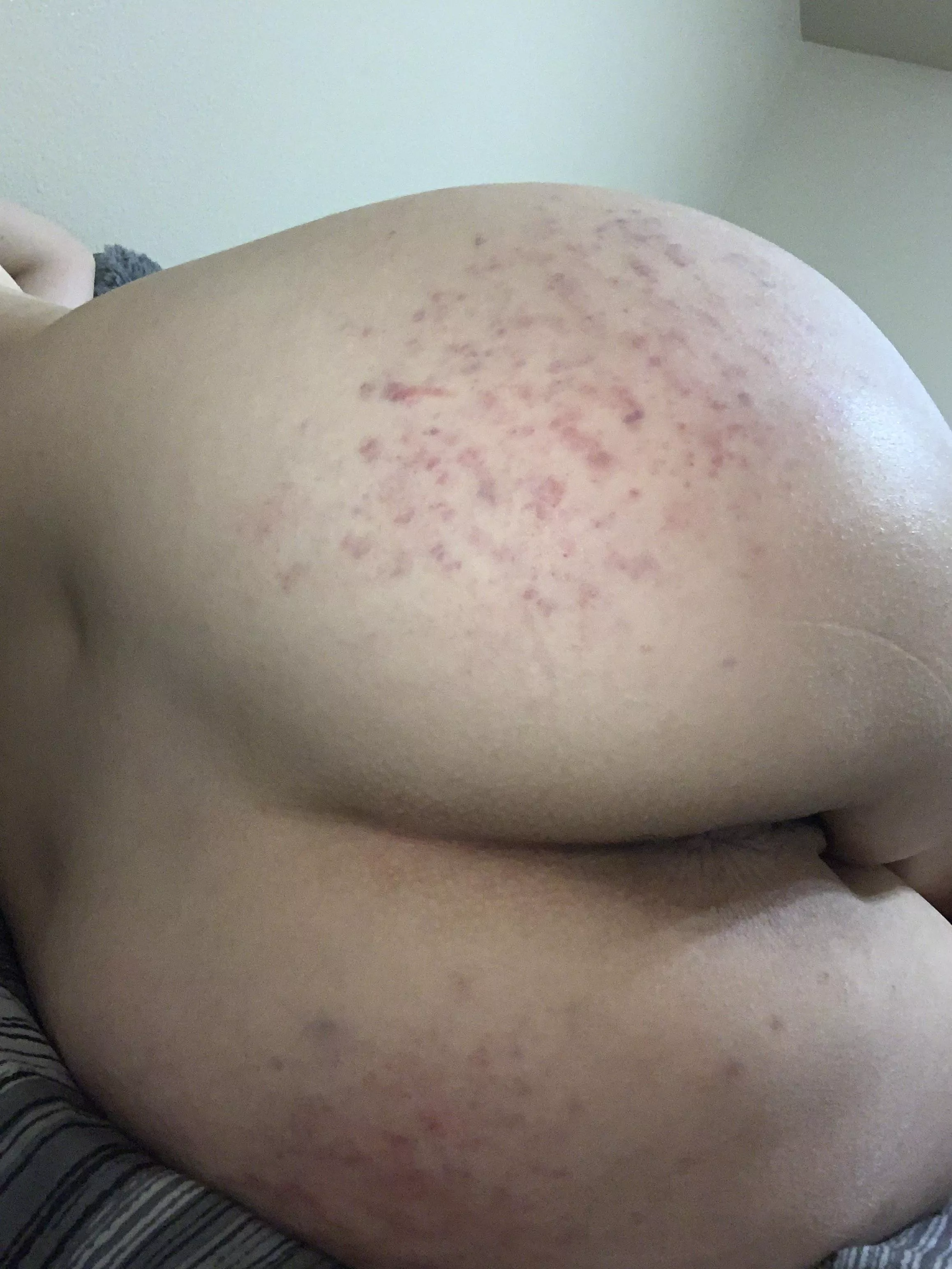 Just a lot of spankings for being such a brat 