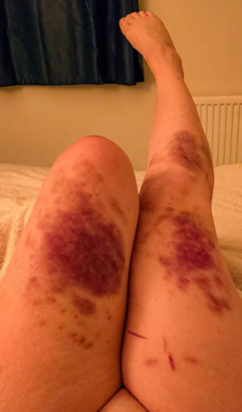 Master told me to hit myself harder, so I did my very best