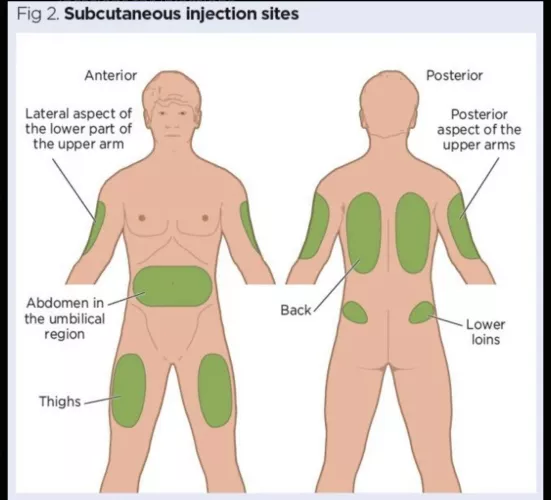 Sub Injection sites 