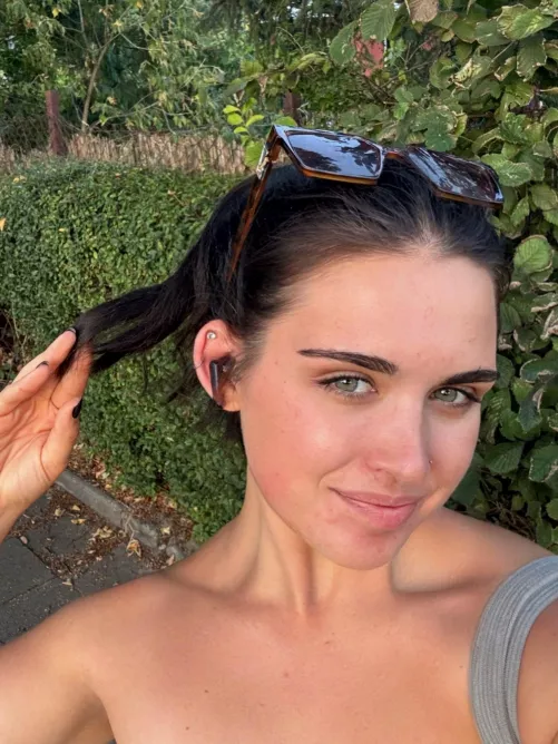 can you count how many freckles i have?