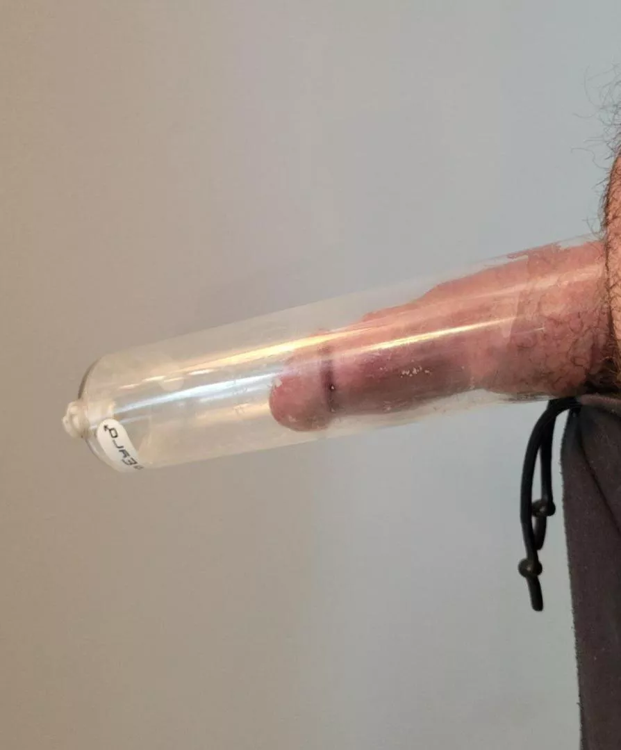 The base has been blowing up so fast