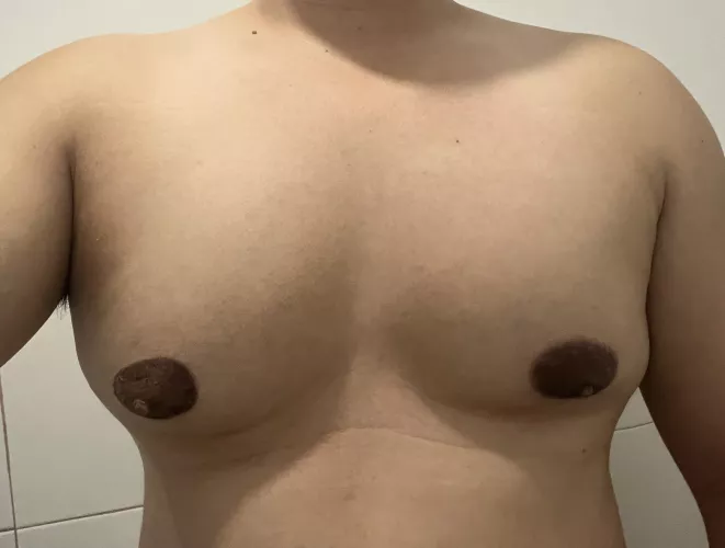 Areala getting crazily big