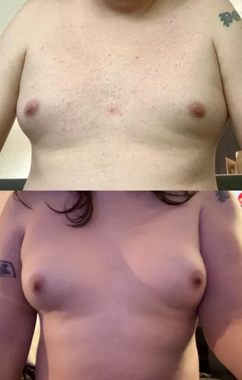  June 2020 (5 months on HRT) vs Today (57 months)