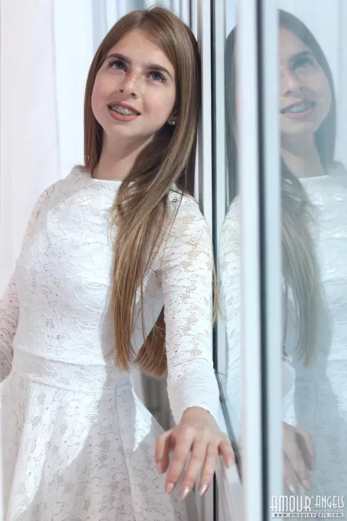 Rina with braces in (and out of) a pretty white dress