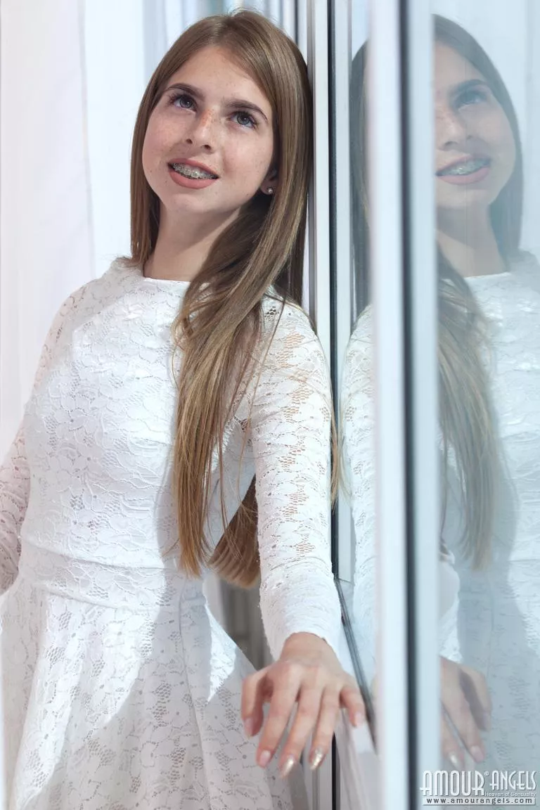 Rina with braces in (and out of) a pretty white dress