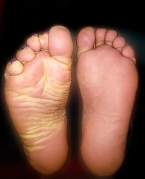 can i rub your cock with my wrinkled sole while you do whatever you want with my paralyzed foot?