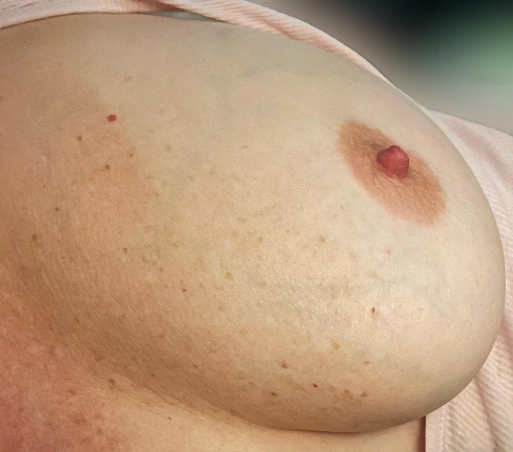 My freckles demanded a close-up [F56]