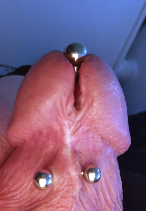 Update Cutted Frenum