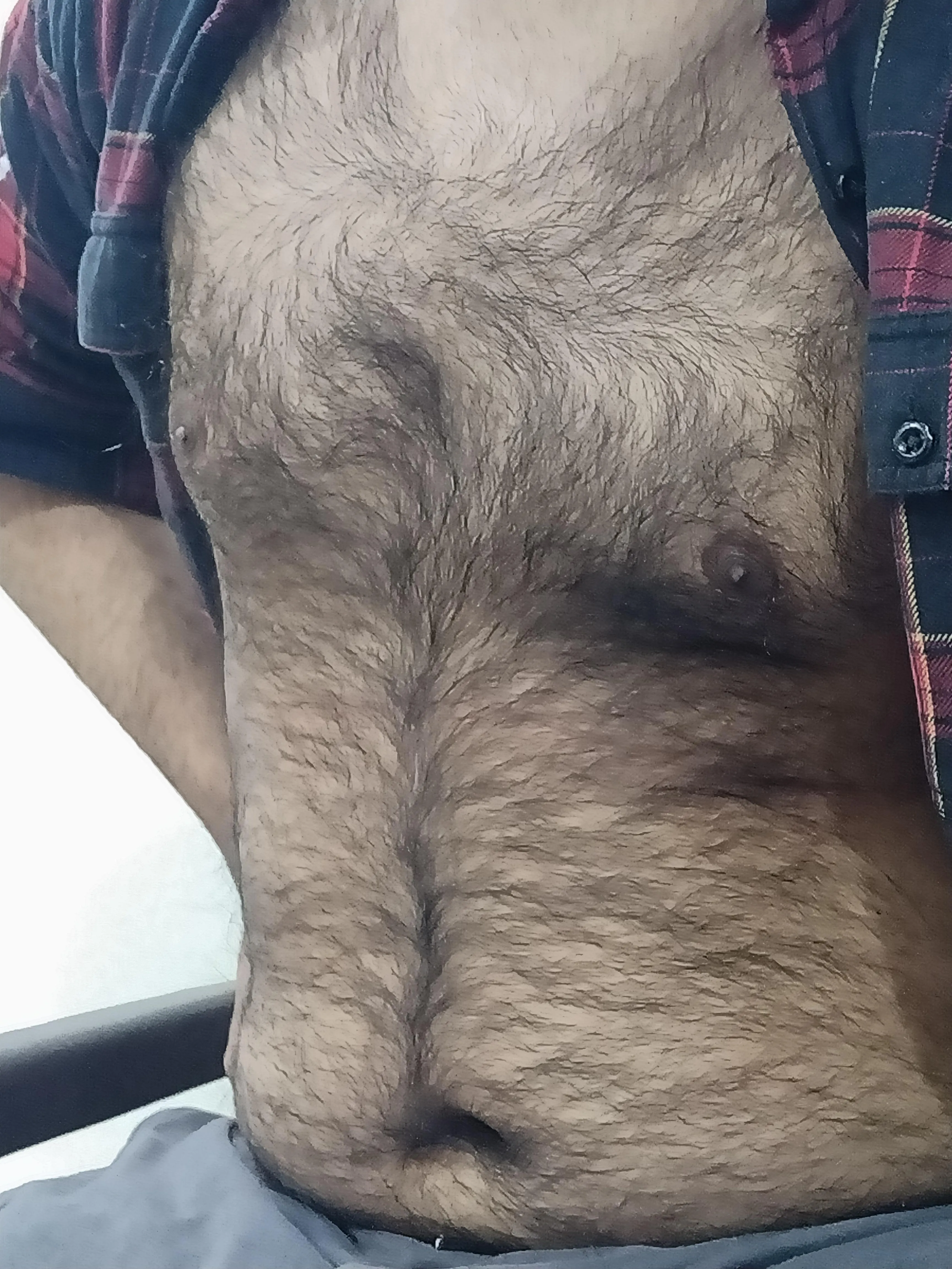 28 Indian hairy