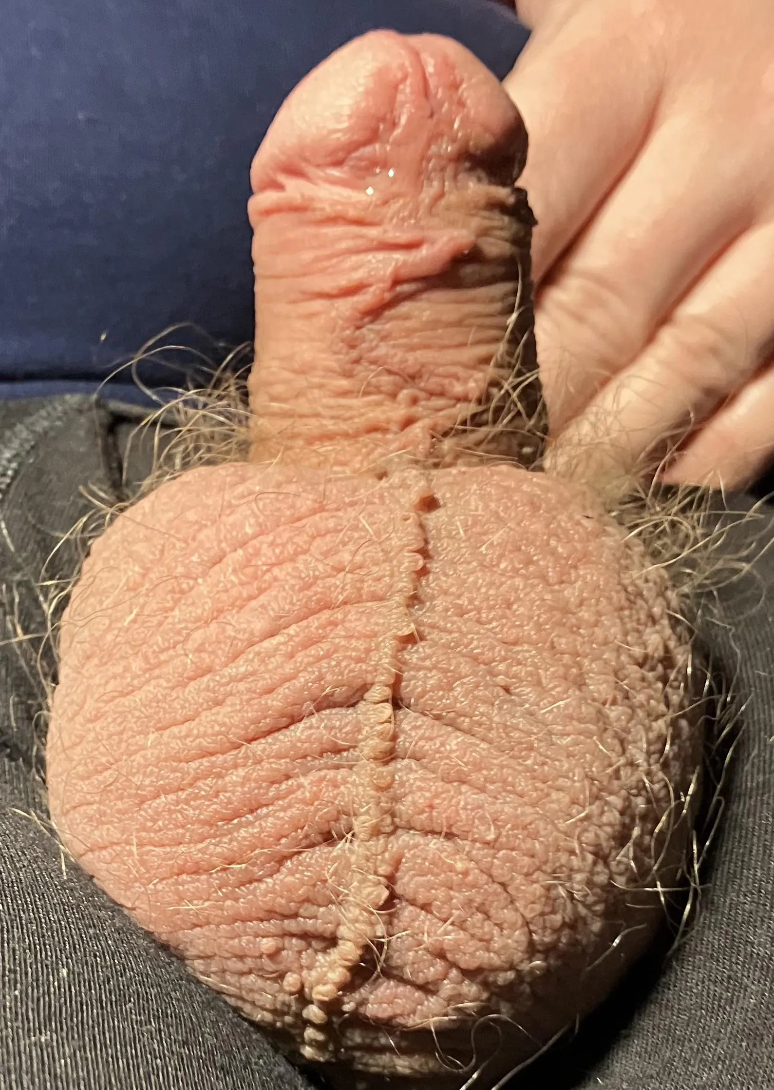 Always been self conscious about my scar