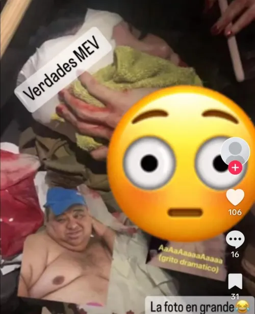 Veronica Guzman after Diana Esparragoza beat her with a bottle for having an affair with her (now ex) husband Alfonso Tirado “El Caballero”