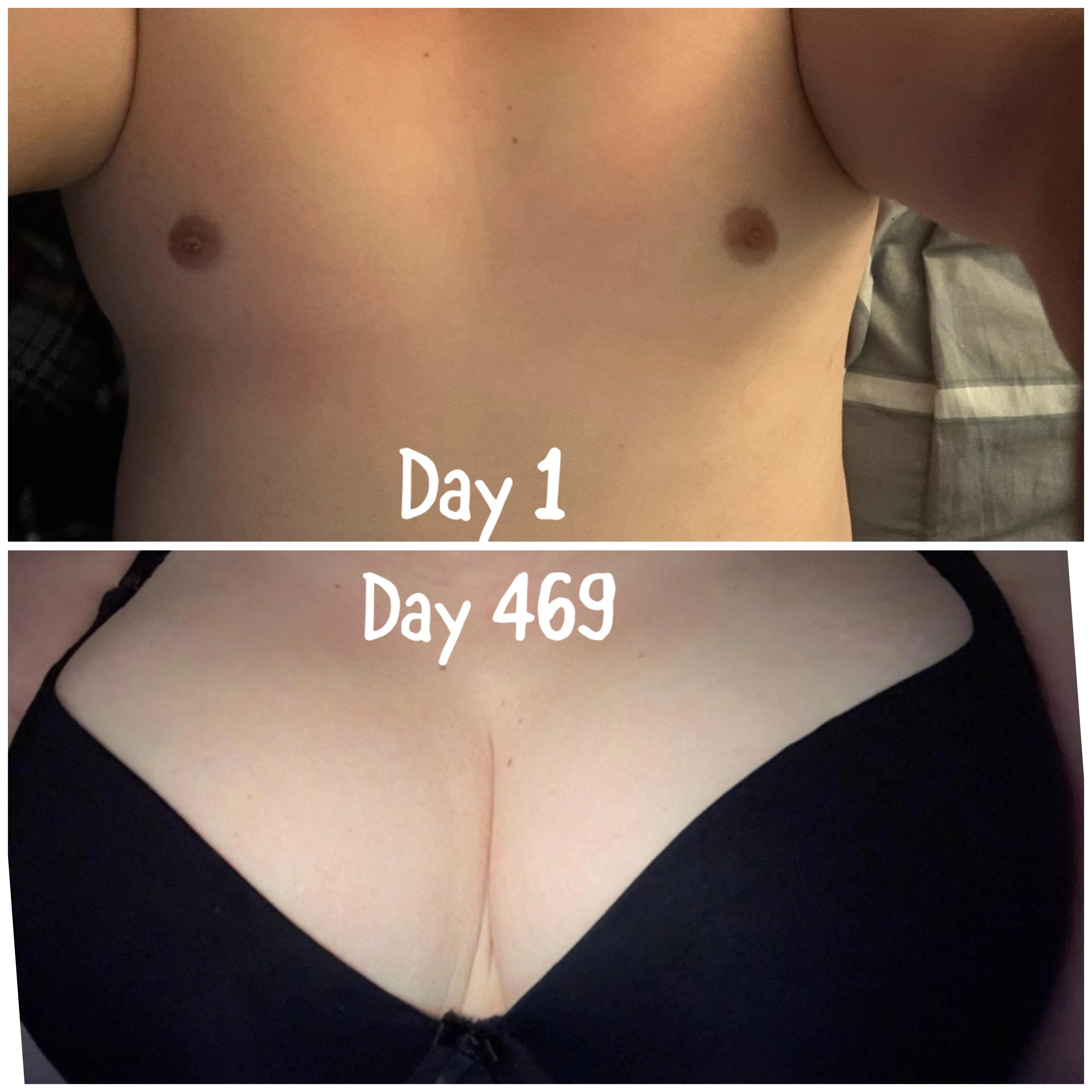 469 days (15.5 Months) HRT - 33 y.o.