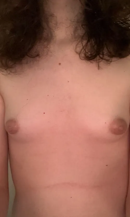 7 months hrt. (200mg spiro, 6mg estradiol)