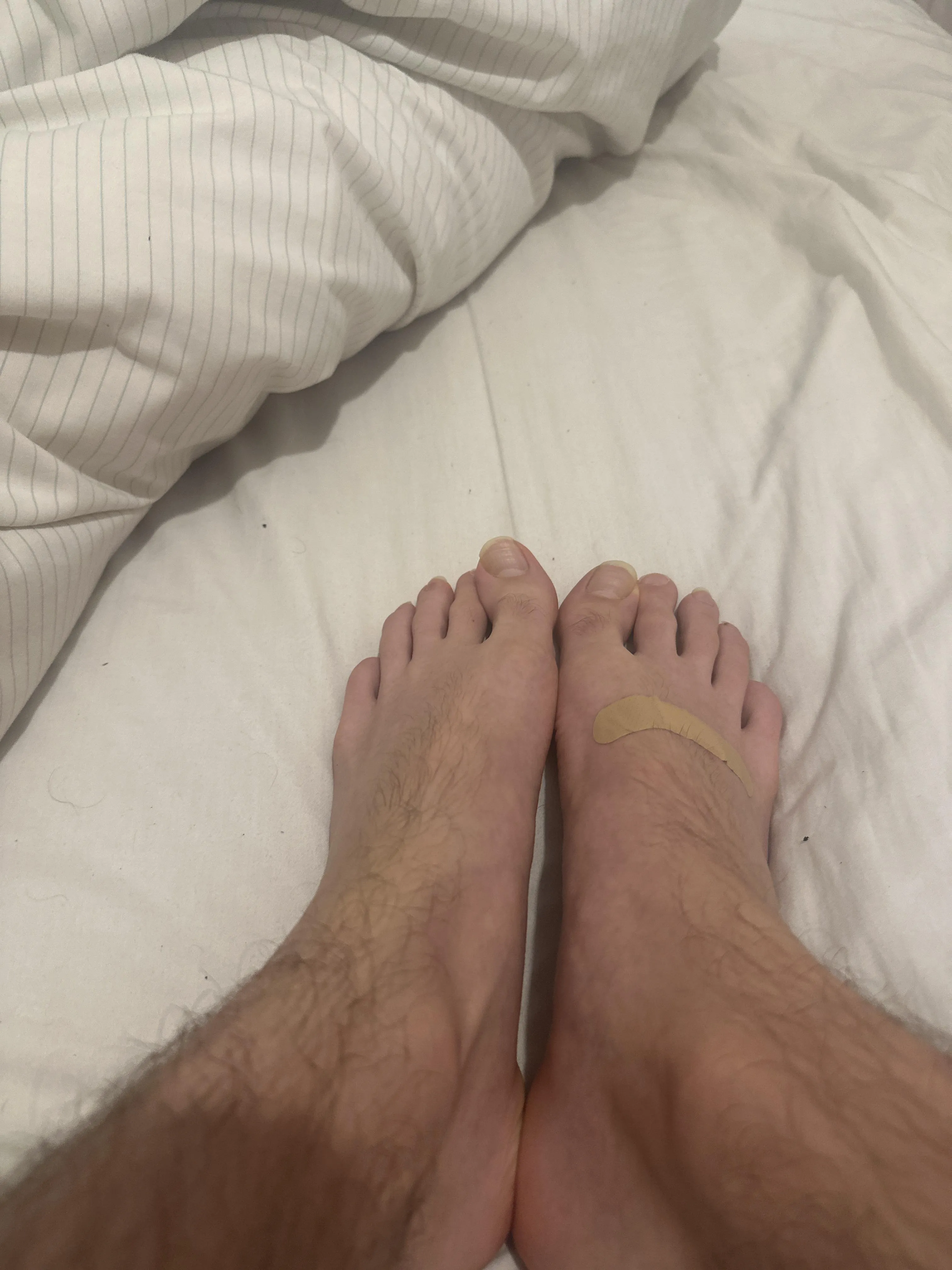 Someone come kiss my feet better