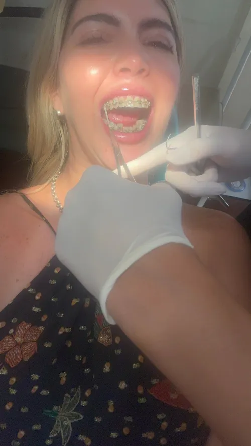 Tensioner adjustment today