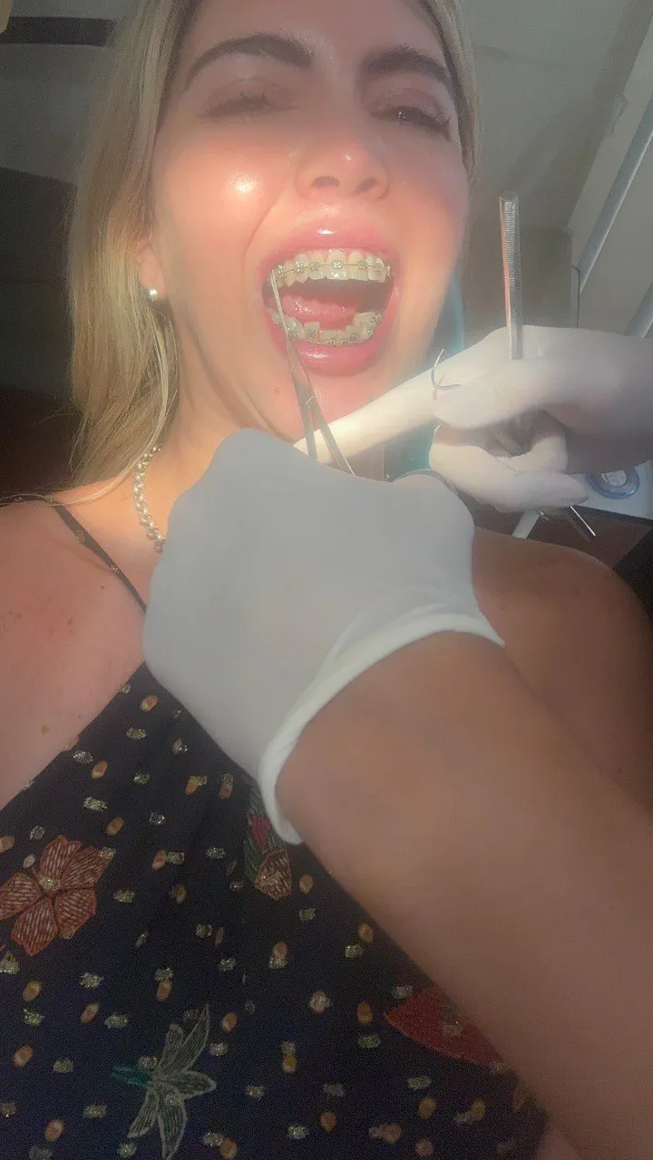 Tensioner adjustment today