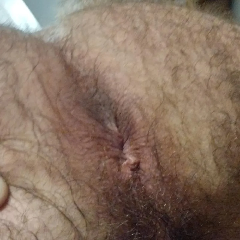 Want my hole leaking
