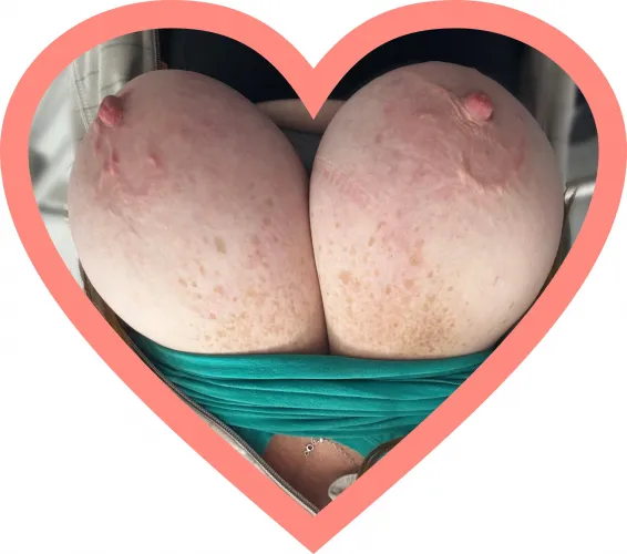 Well, since I was invited here and it’s Valentine’s Day…