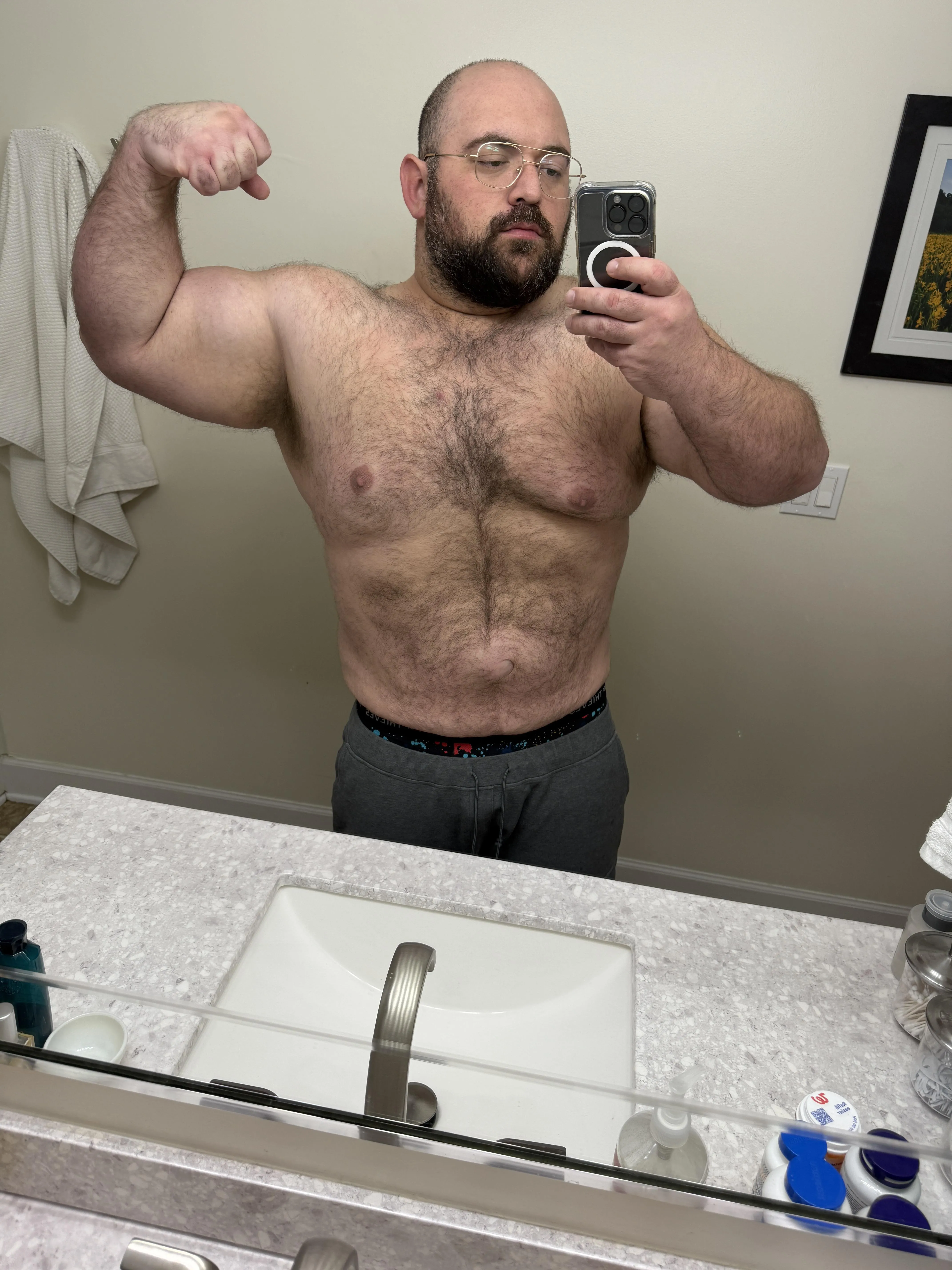 Just lost 100lbs but still chubby