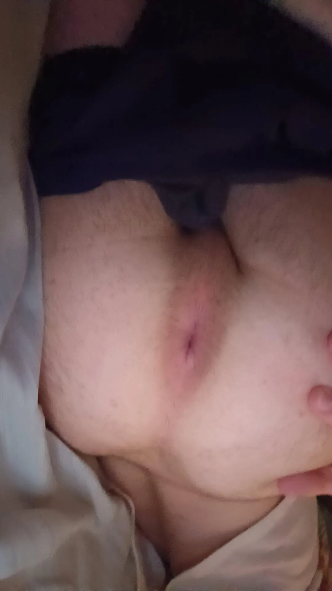 My hole after playing with it