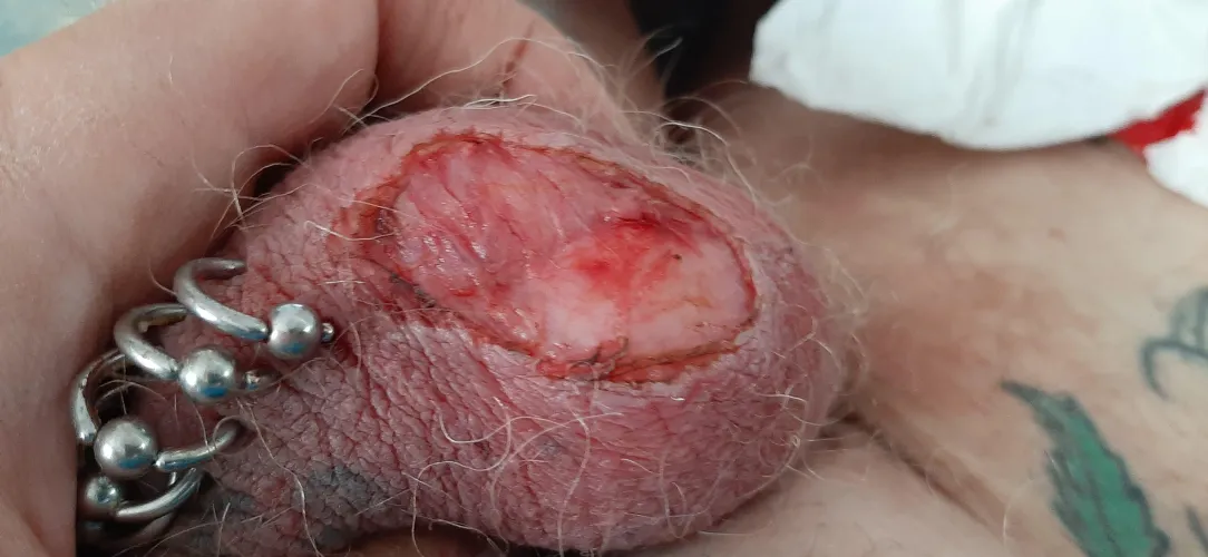 A look into the sack