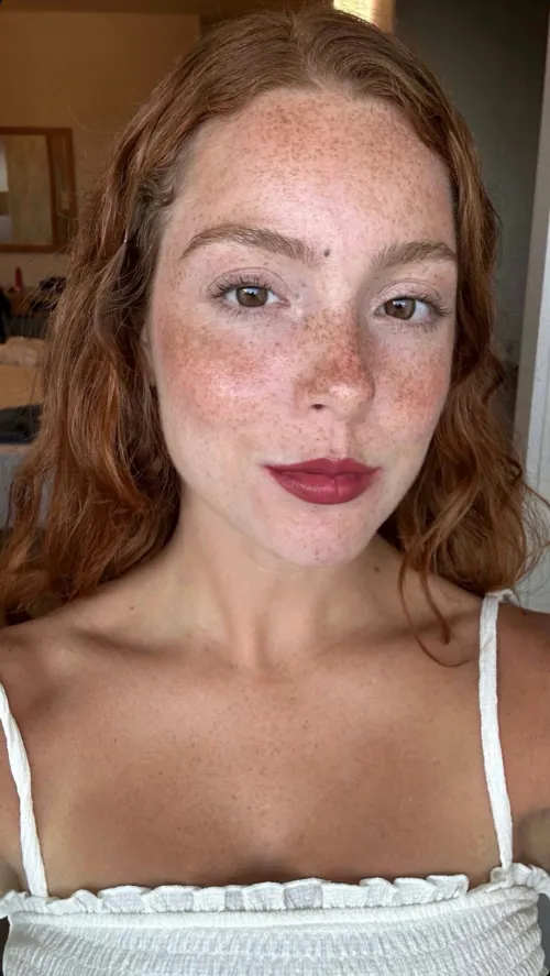Freckles