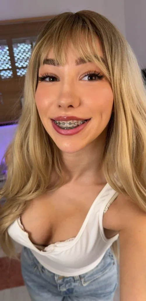 am i cute with braces?