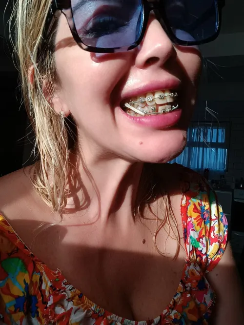 I love the way my braces catch the light… but I love the way you stare even more.