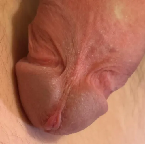 What methods should I use to remove my frenulum?