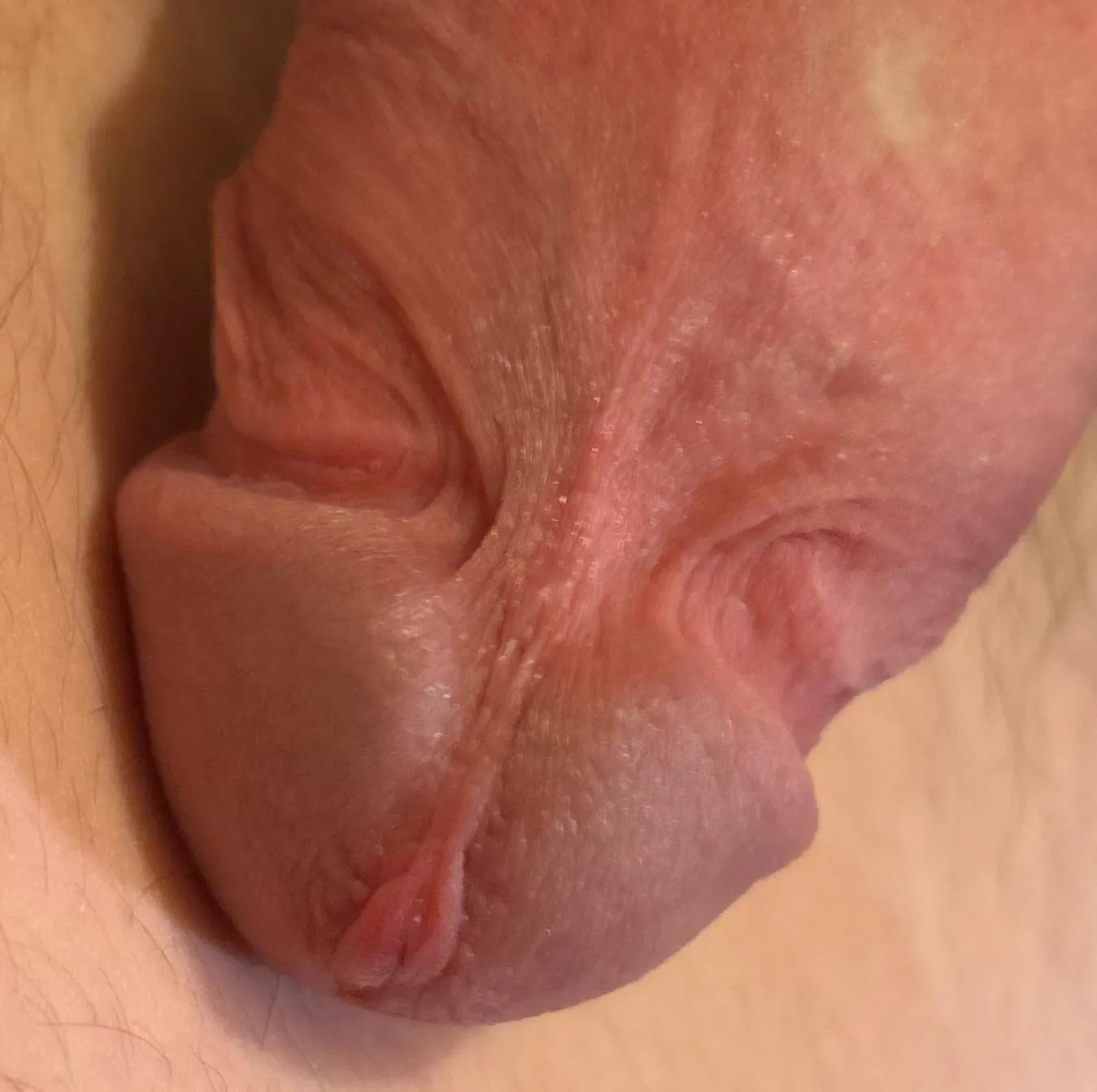 What methods should I use to remove my frenulum?