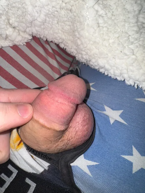 My scar is a constant reminder (21)