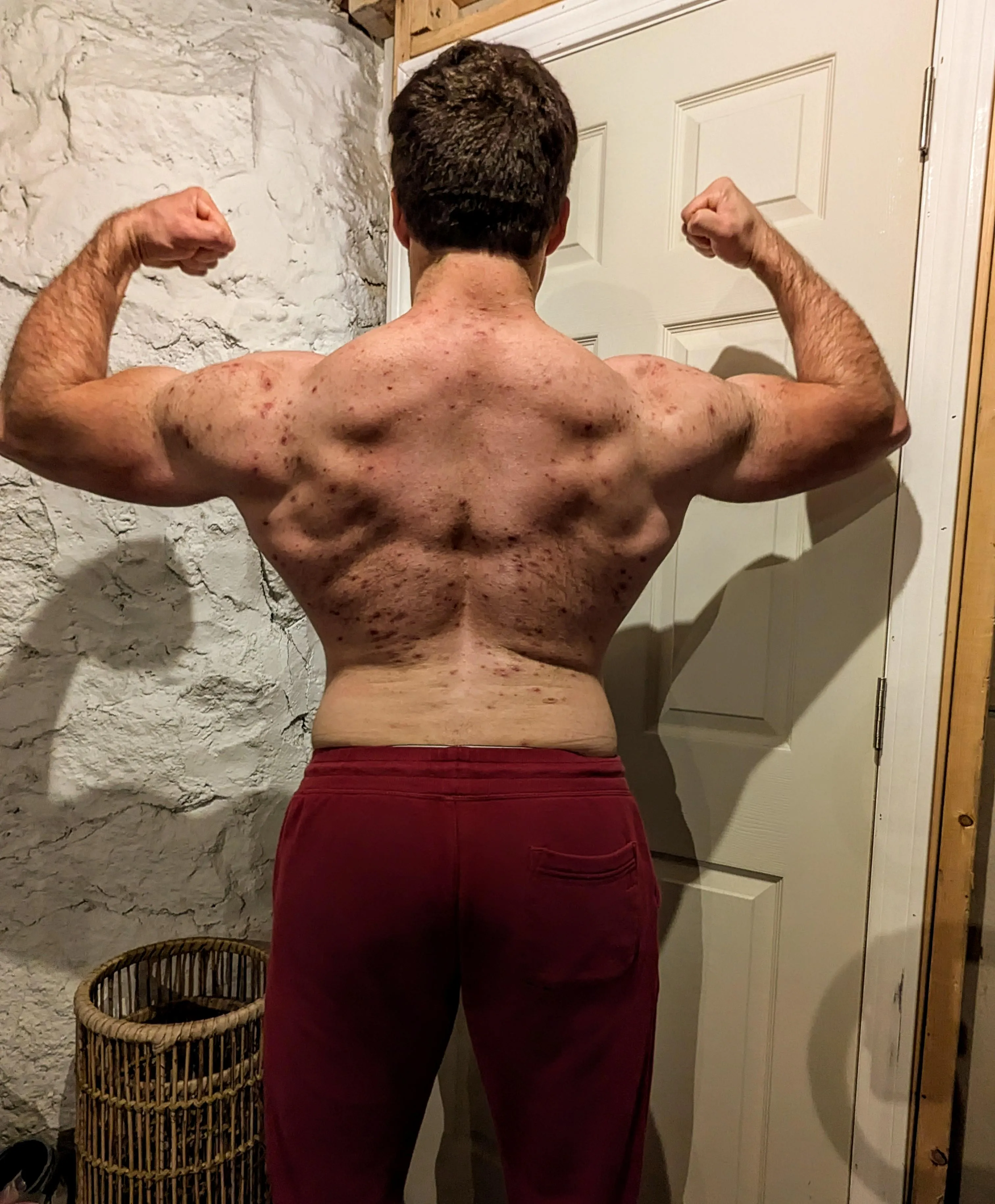 My back is so sensitive