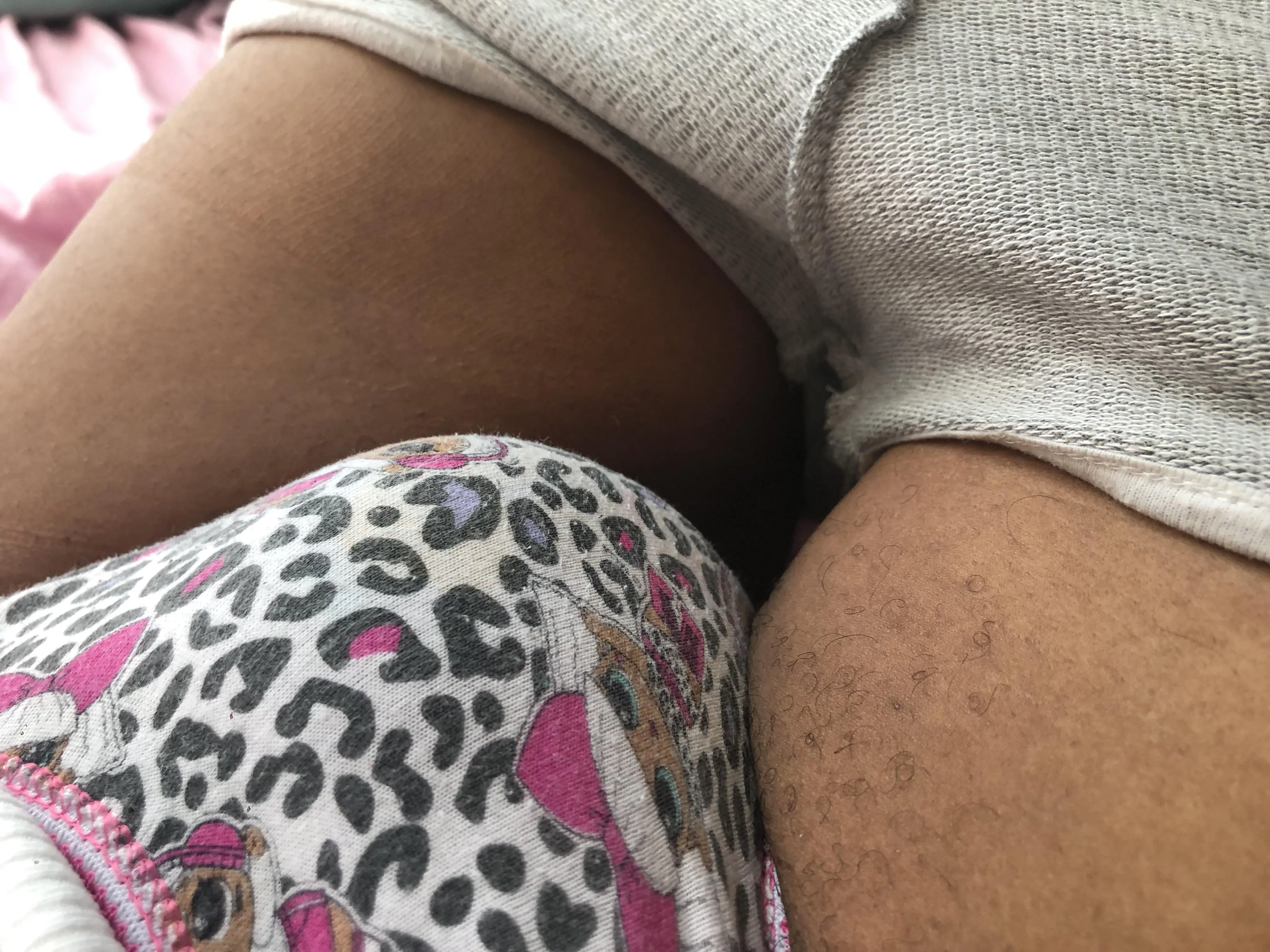 What do you think? 9” bulge!