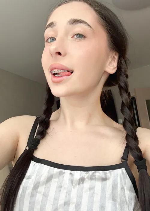 With my bright smile, who needs sunshine