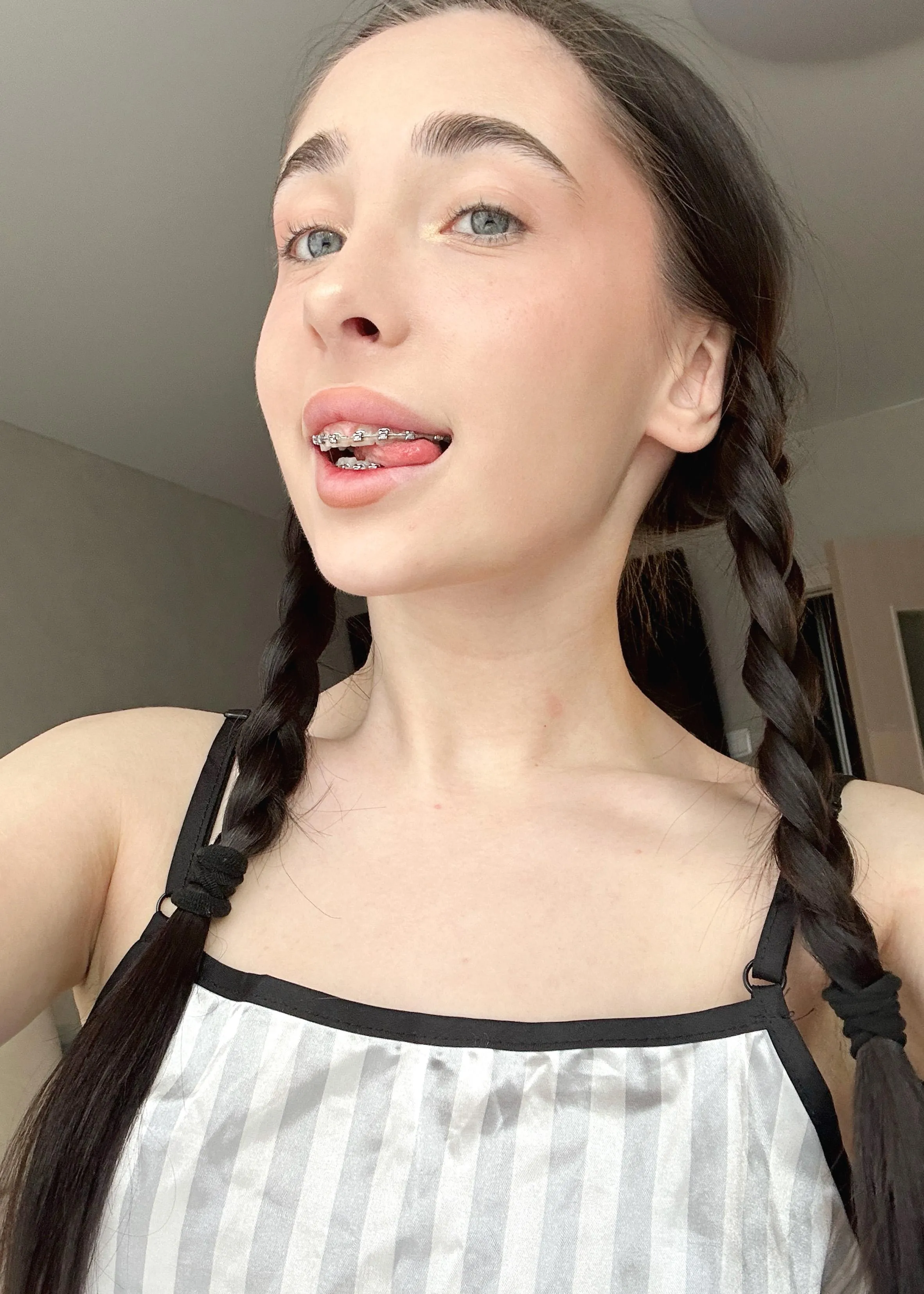 With my bright smile, who needs sunshine