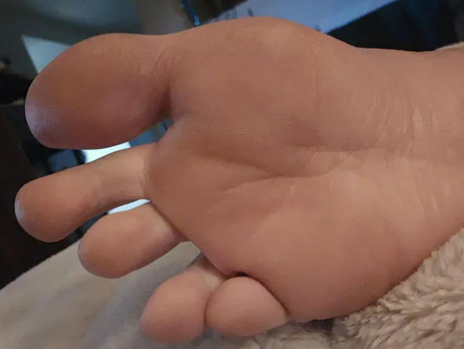 Count the creases 🥰