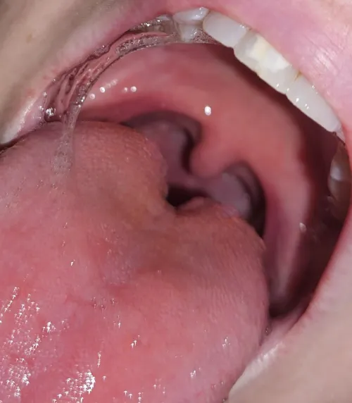 Flamin' hot cheetos mouth