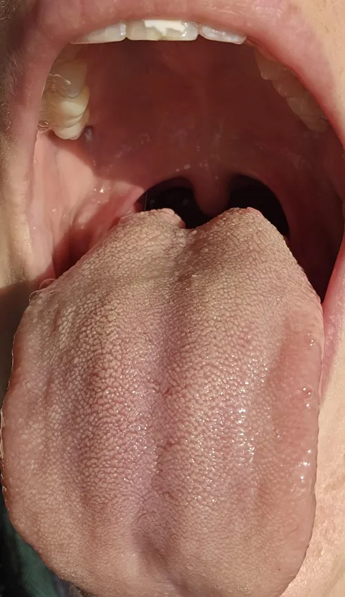 Good morning. I'm looking for recruits for a potentially deadly tongue scrubbing mission.