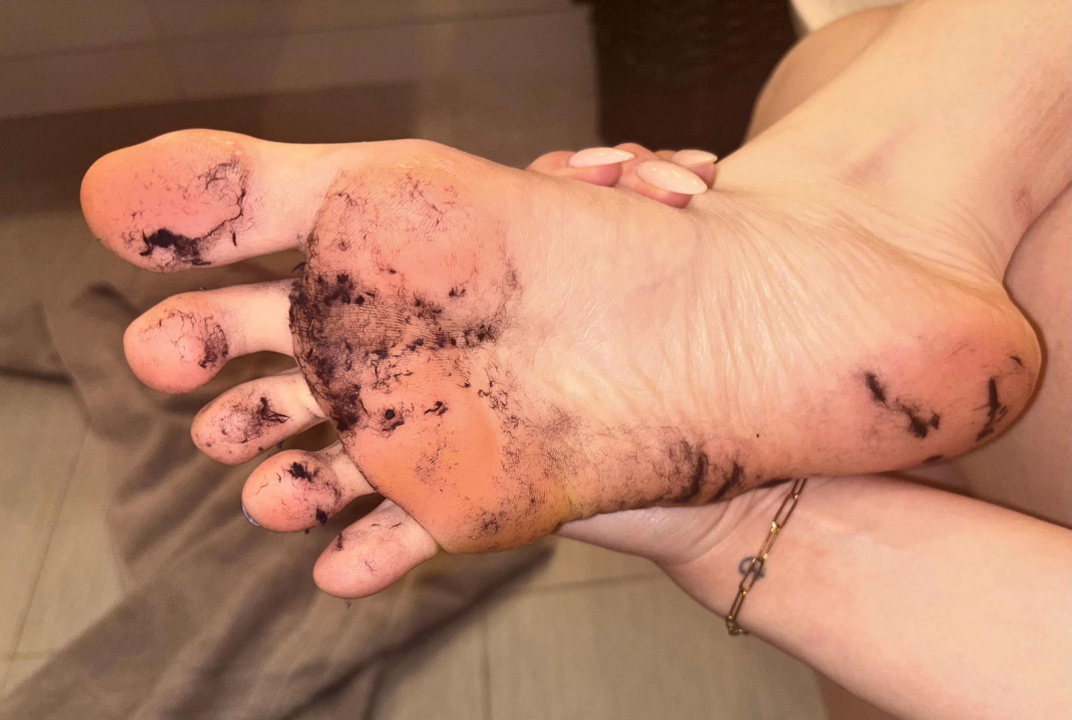 Gym socks left my feet all sweaty and fuzzy😩