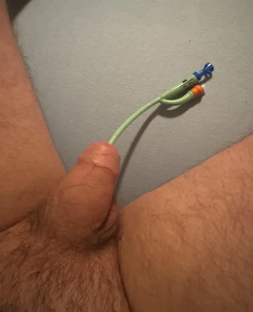 After some time a cath again. CH16 for the beginning