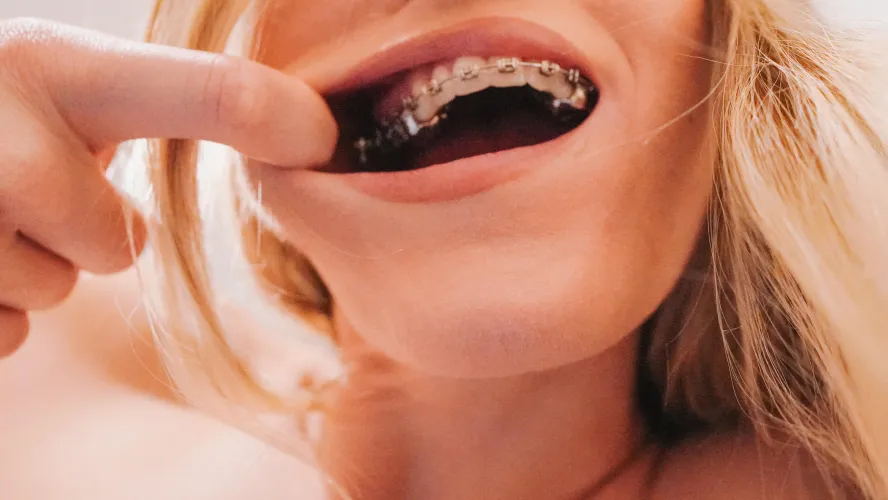 Best catch of the day