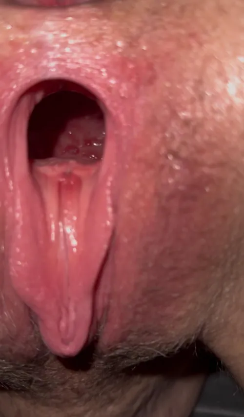 Damn I love the progress we are making