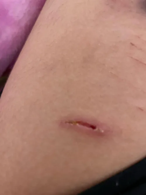 how deep??? will it scar????  (trigger warning for self harm!) please don’t click if you will get triggered!