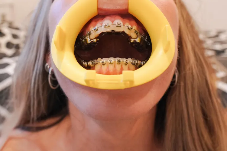 You don’t even wanna know how hard this was to get in. Or maybe you do? That’s probably more likely